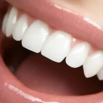 The Science Behind Lithium Disilicate Blocks: Properties and Applications in Dentistry