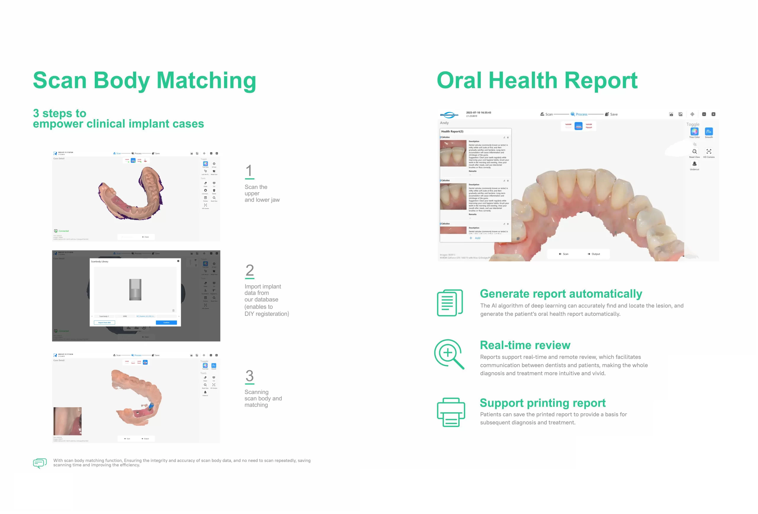 Intraoral Scanner-1