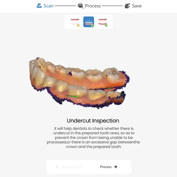 Intraoral scanner